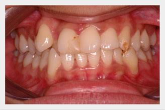 10 Views of Dental Photography