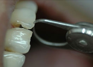 Clinical Applications of Dental Photography