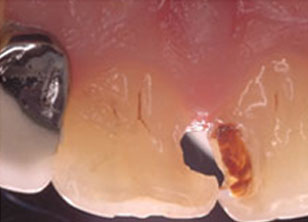 Clinical Applications of Dental Photography